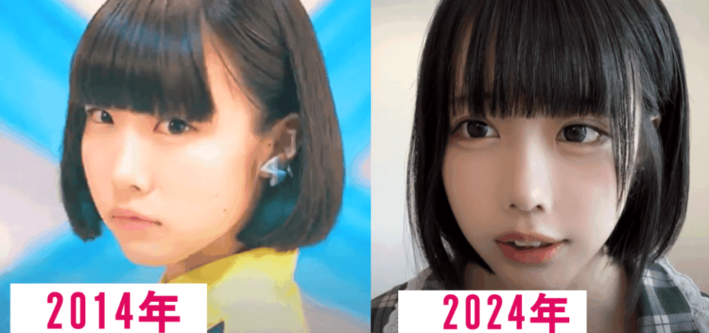 あのちゃんビフォーアフター②