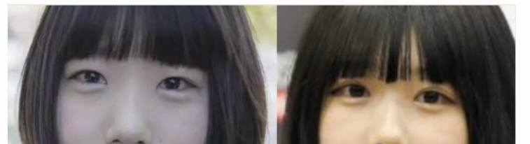 あまちゃん目元ビフォーアフター。涙袋は前からあったようだ